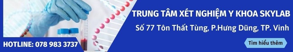 xét nghiệm ký sinh trung thành phố vinh nghệ an
